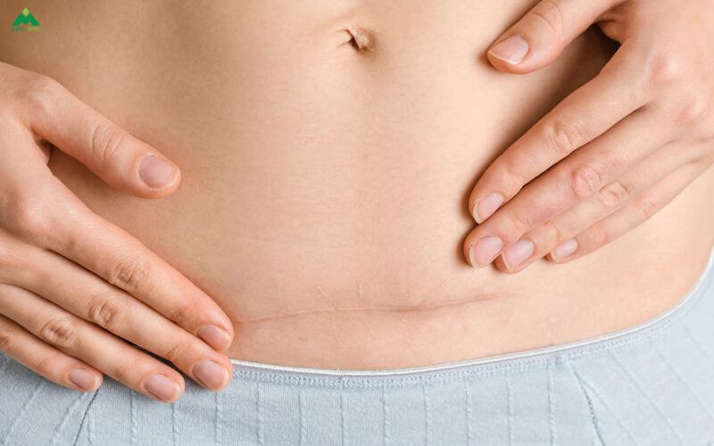 Lợi ích tuyệt vời từ xông hơi sau sinh