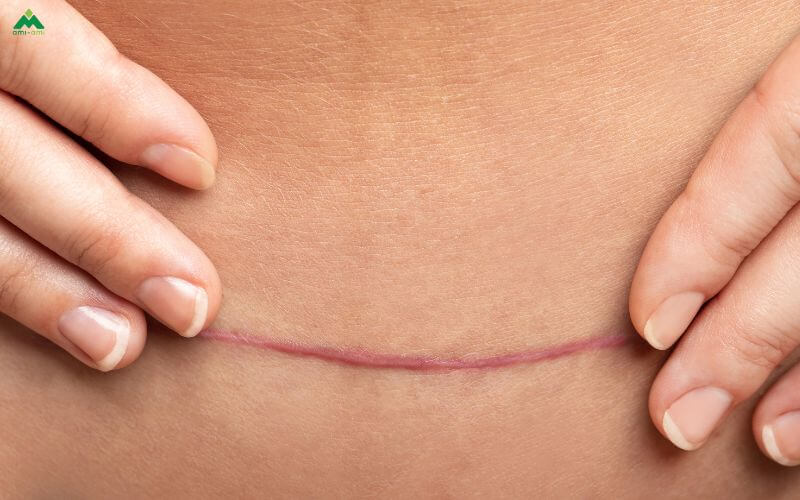 Lưu ý khi xông tại nhà để an toàn & hiệu quả
