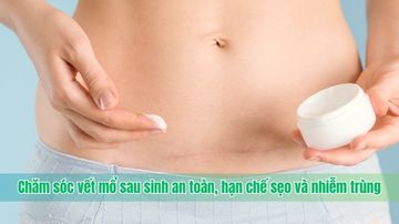 Chăm sóc vết mổ sau sinh an toàn, hạn chế sẹo và nhiễm trùng