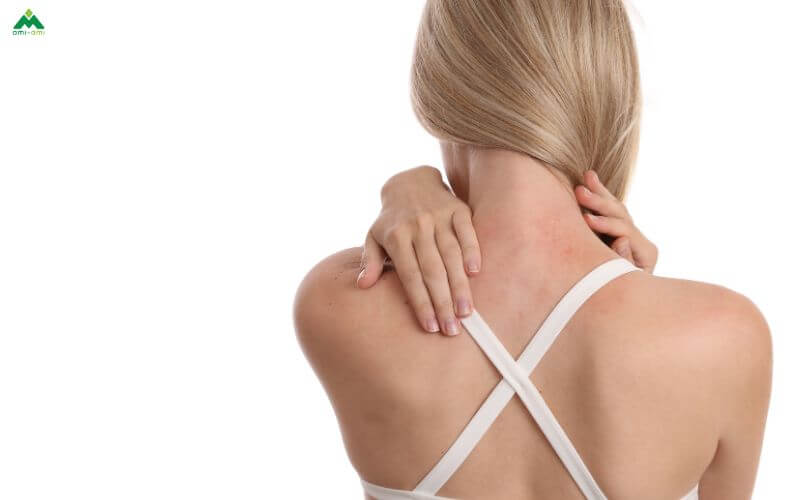 Thử phản ứng với da nhạy cảm