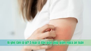 Bị ghẻ tắm lá gì? 5 loại lá dân gian giúp giảm ngứa an toàn