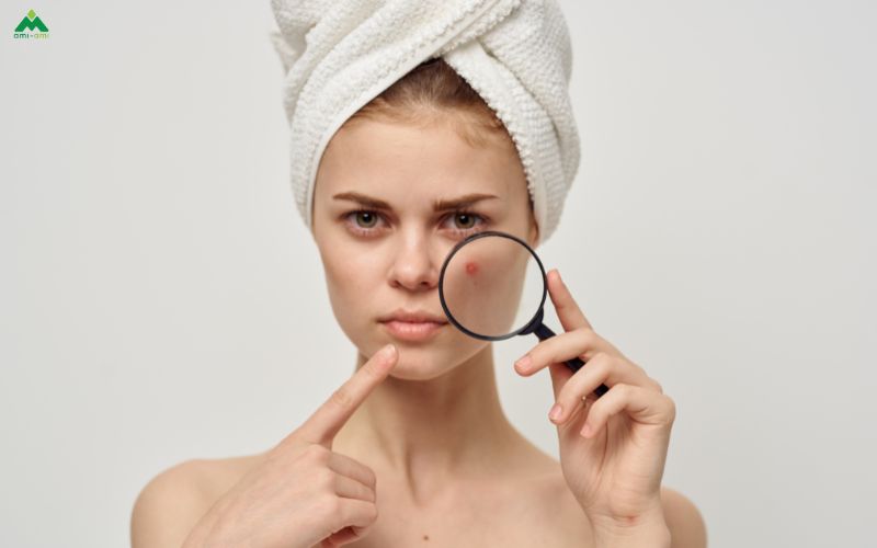 Công dụng của xông mặt bằng lá trầu