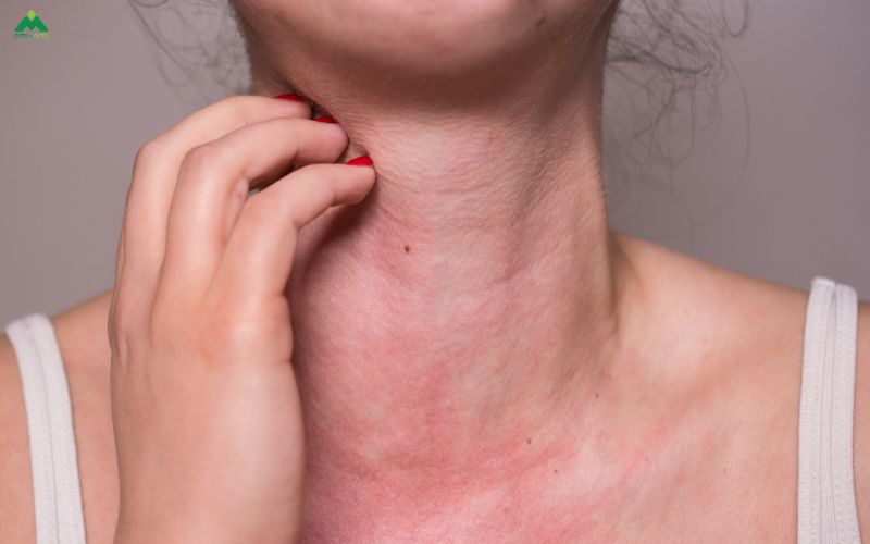 Lưu ý quan trọng khi tắm lá trị ghẻ