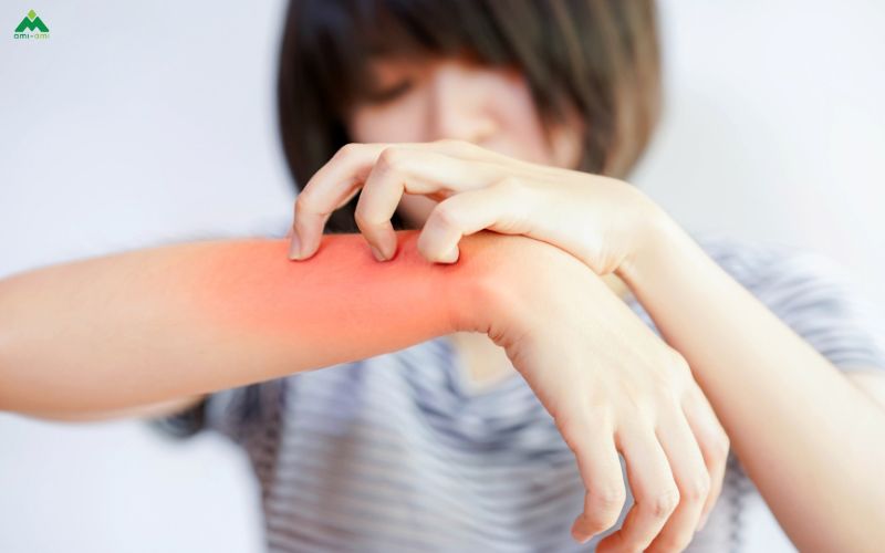 Lưu ý và tác hại tiềm ẩn khi xông mặt bằng lá trầu