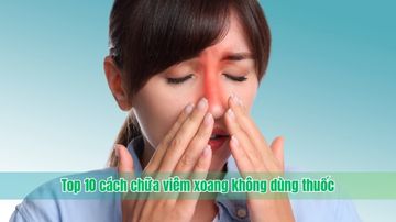 Top 10 cách chữa viêm xoang không dùng thuốc