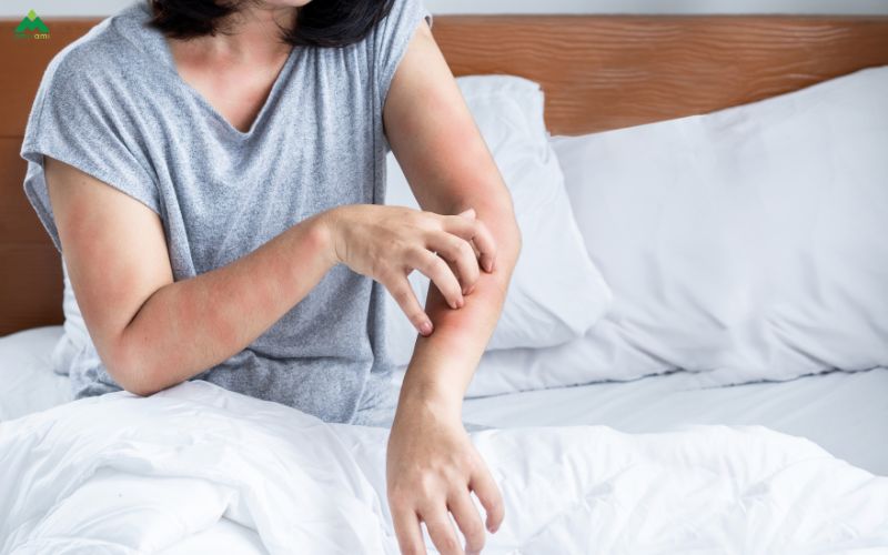 Vì sao tắm xong bị ngứa?