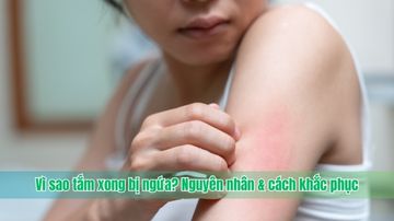 Vì sao tắm xong bị ngứa? Nguyên nhân & cách khắc phục