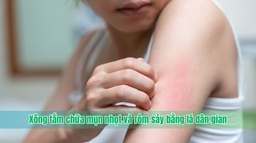 Xông tắm chữa mụn nhọt và rôm sảy bằng lá dân gian