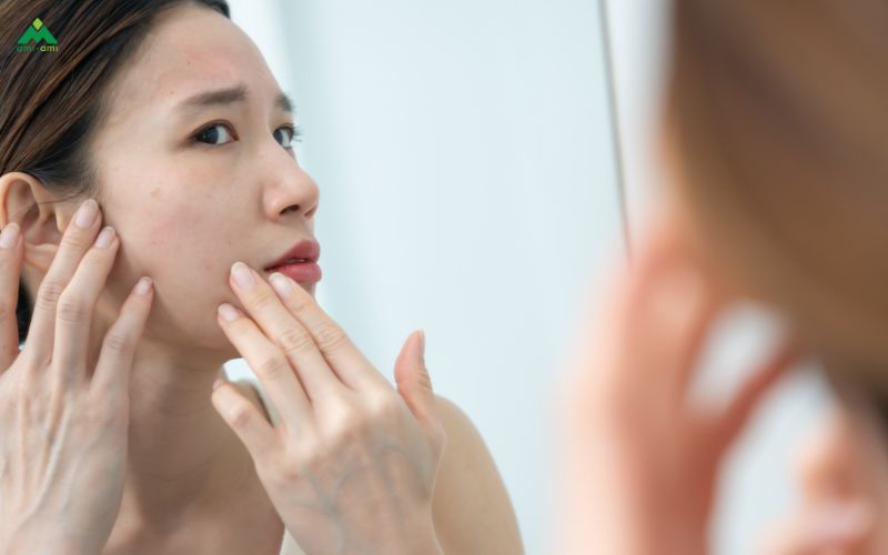 Xông mặt bằng lá diếp cá có tác dụng gì?