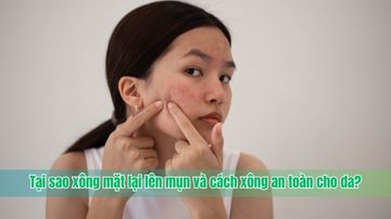 Tại sao xông mặt lại lên mụn và cách xông an toàn cho da?