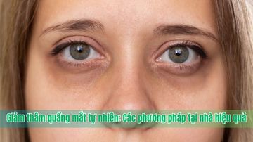 Giảm thâm quầng mắt tự nhiên: Các phương pháp tại nhà hiệu quả