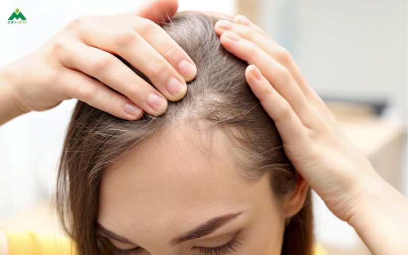 Nguyên nhân khiến tóc khó mọc hoặc chậm mọc