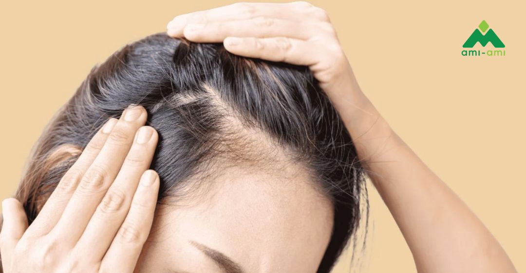 Nên làm gì để giảm gãy rụng tóc?