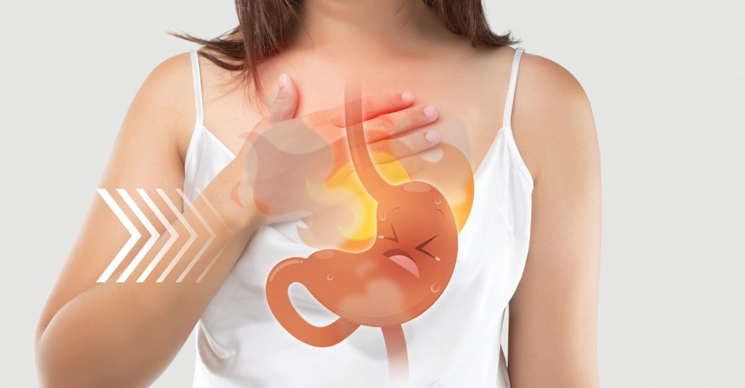 Trào ngược dạ dày thực quản (GERD)