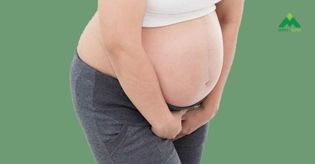Các phương pháp phòng tránh viêm nhiễm phụ khoa an toàn cho mẹ bầu