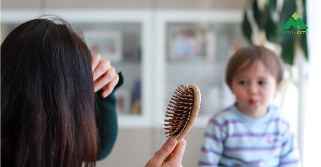 Các biện pháp dân gian hỗ trợ giảm rụng tóc sau sinh