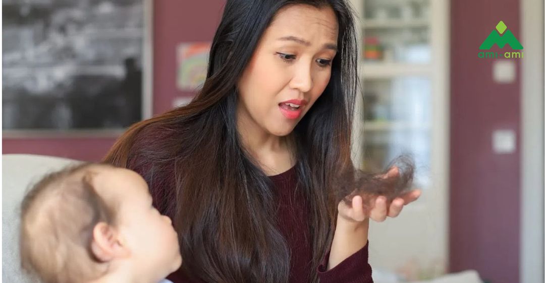 Rụng tóc sau sinh kéo dài bao lâu?