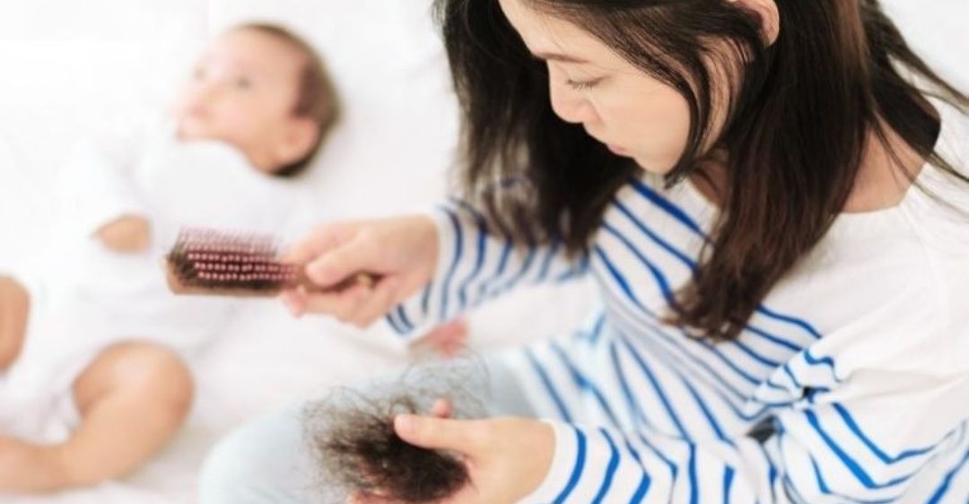 Nguyên nhân gây rụng tóc sau sinh