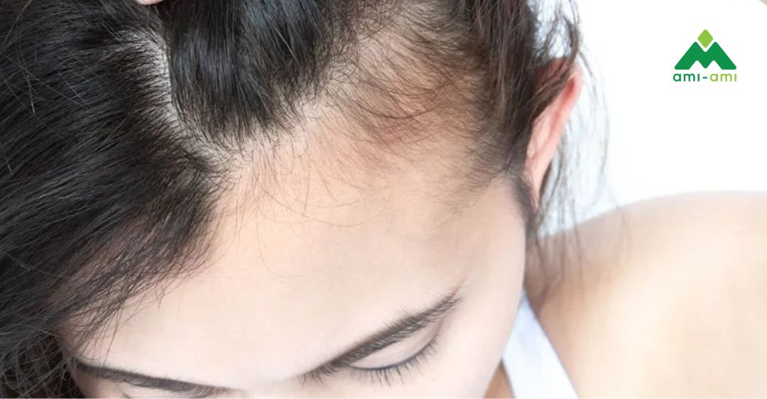 Rụng tóc sau sinh xảy ra như thế nào?