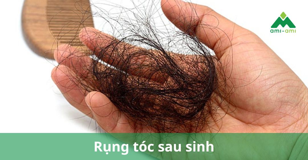 Rụng tóc sau sinh