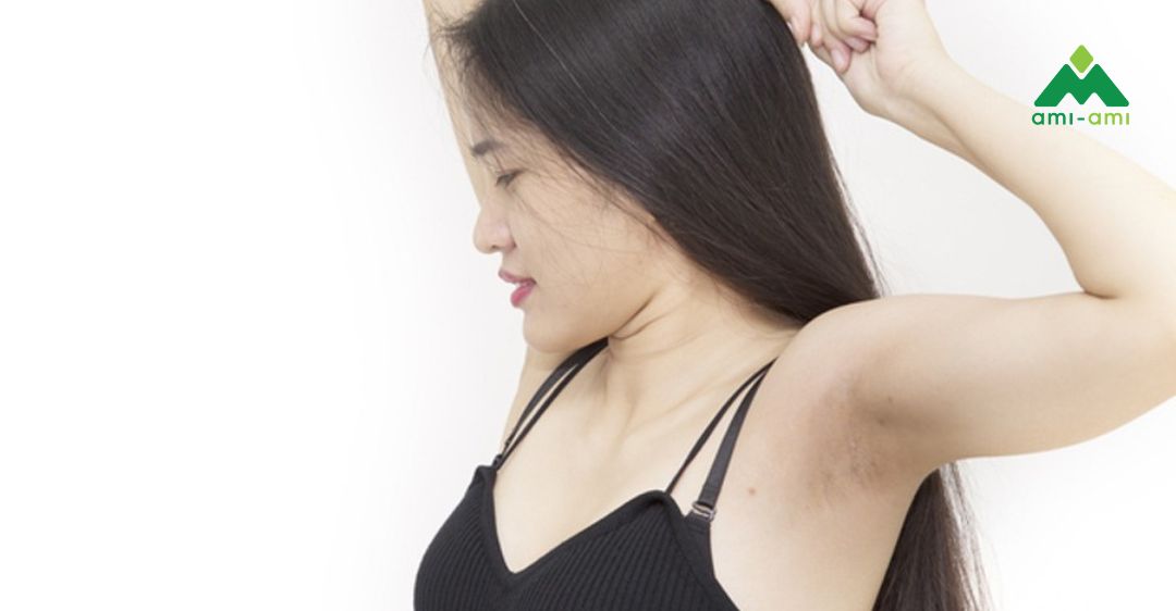 Nguyên nhân gây mùi cơ thể sau sinh